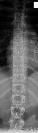 AP Dorsal Radiography